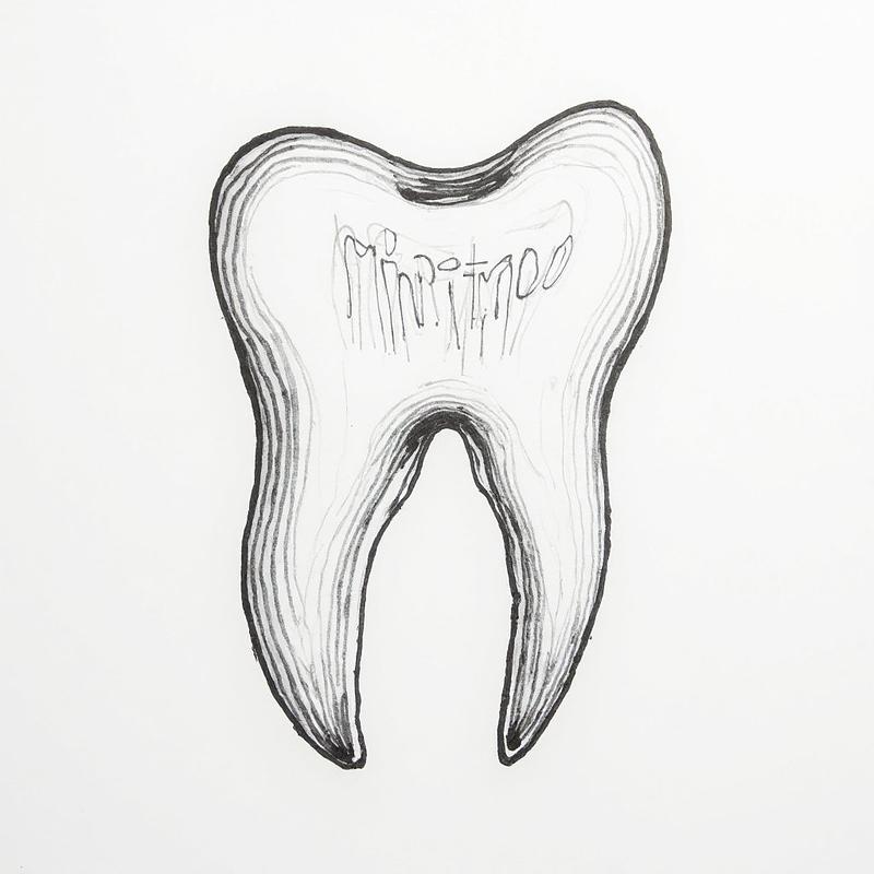 Dent